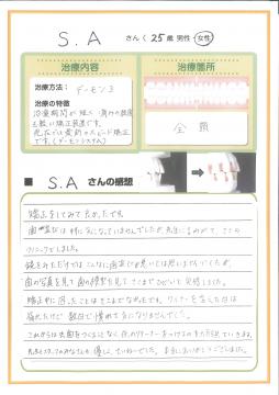 鏡を見ただけではこんなに歯並びが悪いとは思いませんでした
