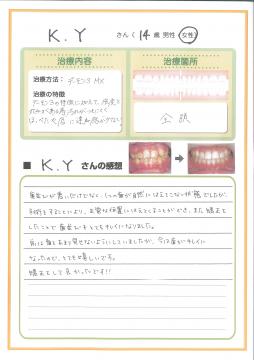 前は歯を見せないようにしていたけどキレイになって嬉しい